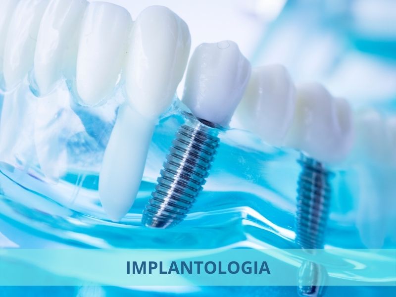 implantologia Cremona